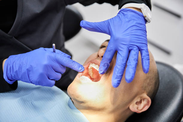 Best Emergency Dental Care for Abscessed Tooth in Bolinas, CA